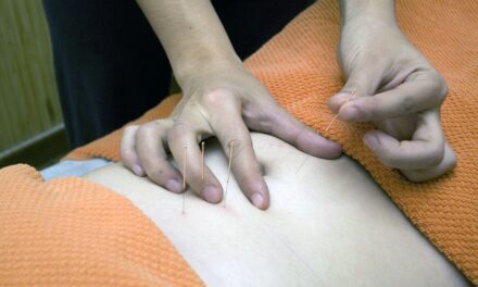 Acupuncture